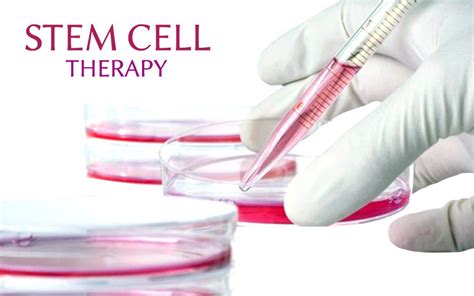 stem cell therapy shows potential  treating medication resistant