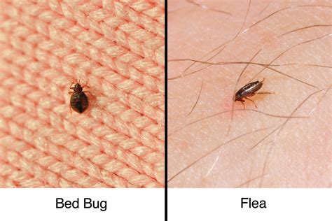 bed bug bites  fleabites     difference  healthy