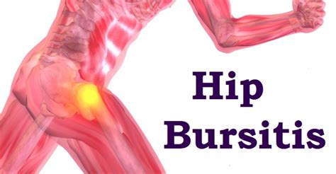 hip bursitis symptoms relief  physical therapy rehab experts