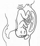 Placenta Fetal Parto Uterus Positioning sketch template