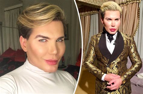 The Human Ken Doll Reveals He Pays For Surgery With Inheritance Daily