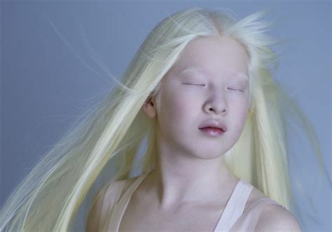 albino people dye  hair detailed guide beauty milly