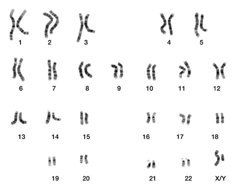 cientistas afirmam   metade  cromossomo  composto