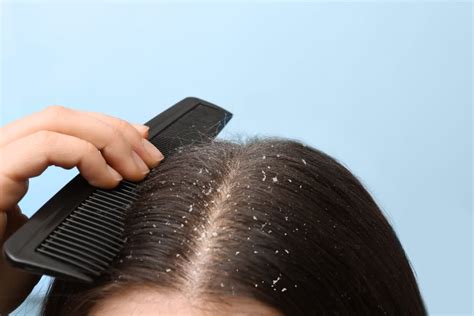 brushing hair    comb  hair  dandruff head