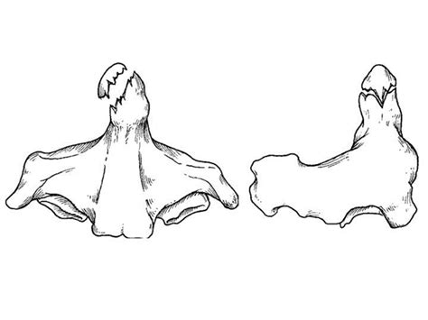 Odontoid Fracture Spine Orthobullets