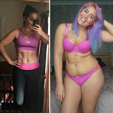 This Anorexia Survivor Bravely Shut Down Body Shamers On