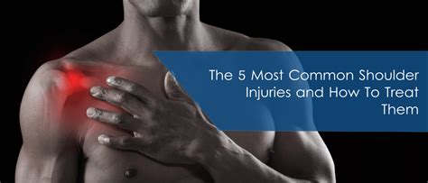 common shoulder injuries health  motion orthopaedic care