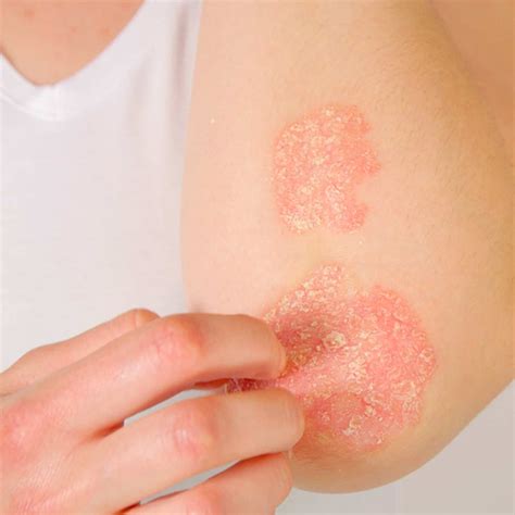 common skin disease true clinic