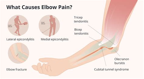 elbow pain  symptoms diagnosis  treatment healthnews