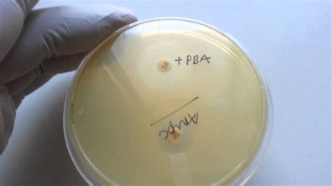 ampc detection  bacteria  laboratory youtube