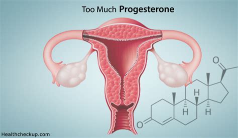 too much progesterone symptoms causes side effects