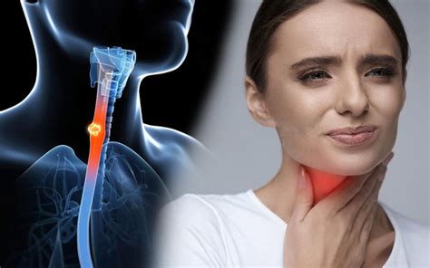 6 of the most common symptoms of throat cancer that you shouldn t