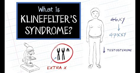 What Is Klinefelters Syndrome Dorothys List