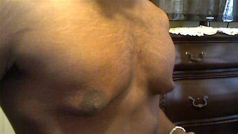 fast breast growth for men