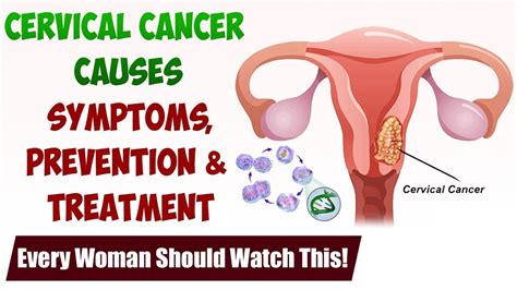 is a uti a symptom of cervical cancer cervical cancer signs and