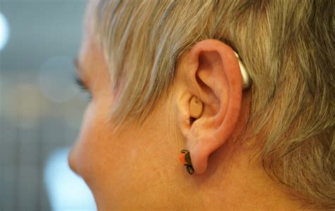 Susie Elelman My Hearing Aids Are A Huge Health Win Starts At 60