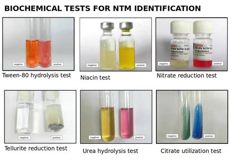 biochemical tests  identify mycobacteria ntm microbe
