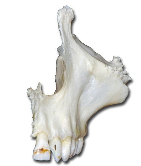 head  neck bones