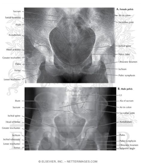 Female And Male Pelvis X Rays