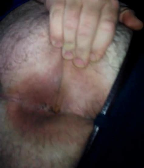 ass farts nasty sick free man hd porn video c6 xhamster