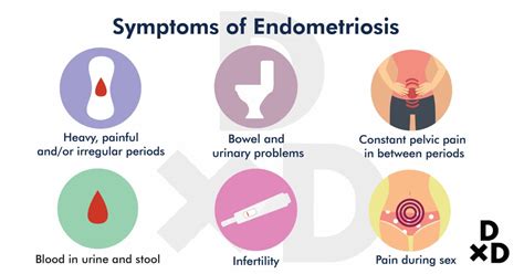 A Complete Guide To Endometriosis Treatment In Singapore 2020
