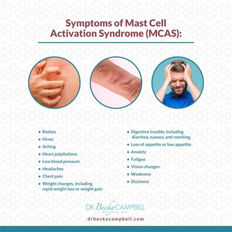 mast cell activation syndrome mcas symptoms   solutions dr becky campbell