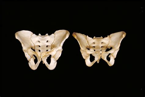 male and female pelvis note the differences in the bony