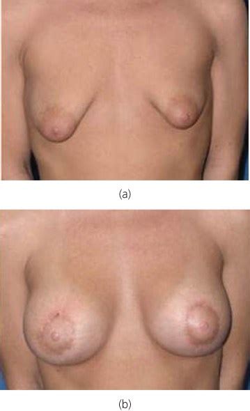 puberty budding breasts datawav