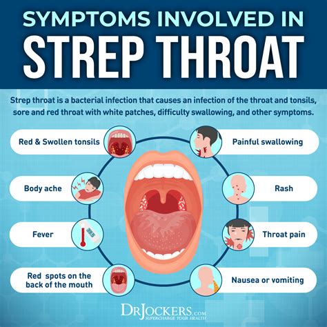 Strep Throat Symptoms And 15 Natural Support Strategies In 2023