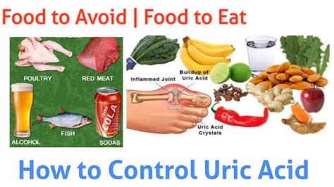How To Control Uric Acid Naturally By Herbs Software And Technology