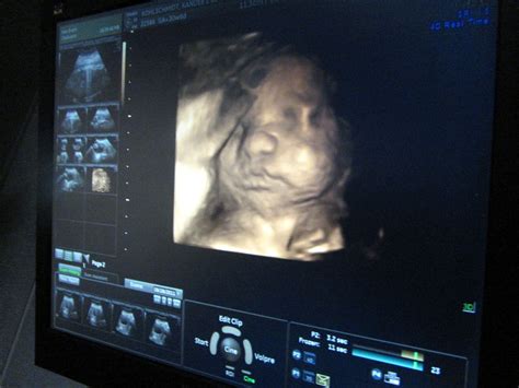 ecografías en 3d durante el embarazo ¿son peligrosas consumer