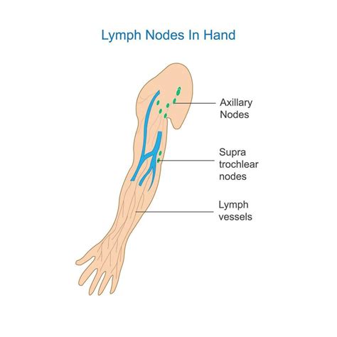lymph node anatomy labeled diagram showing  lymph nodes  hand