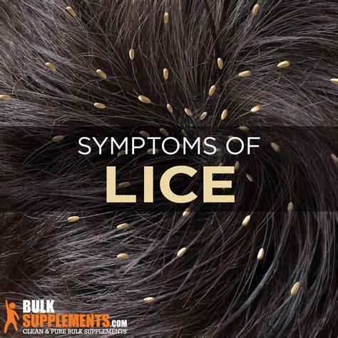 dont  lice ruin  day effective treatment    family