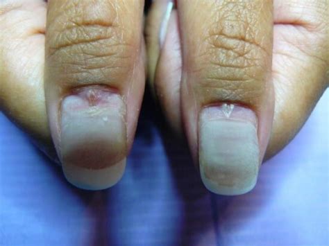 van beschadigde nagels  tips om je nagels te laten herstellen nagelstudio floranails