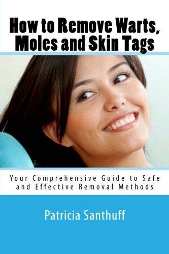 remove moles skin tags and warts skin tags home remedies skin tags on face skin tag removal