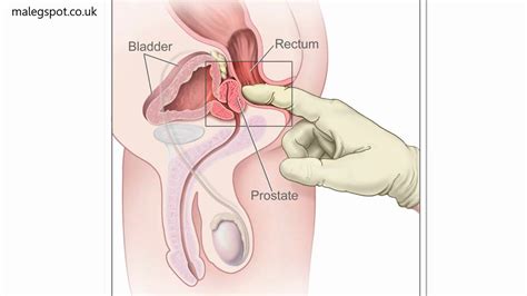 prostate stimulation pleasures of prostate stimulation youtube
