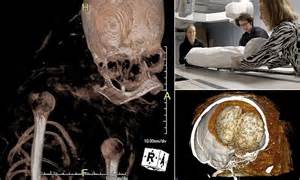 Unravelling The Bandages Of The Royal Hatason Mummy