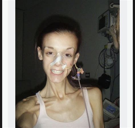 Lina On Twitter 2 Articles About Extremely Anorexic Ppl