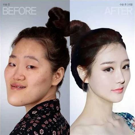 【画像】韓国の超美女たちの 整形前の顔 、もはや誰だか