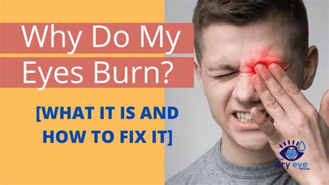 Why Do My Eyes Burn [what It Is And How To Fix It] Eye Love