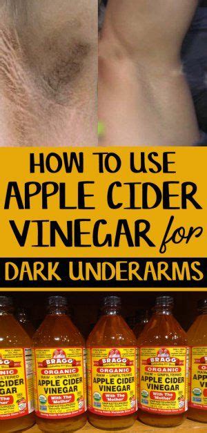 how to use apple cider vinegar for dark underarms 9 diy methods v apple cider vinegar for