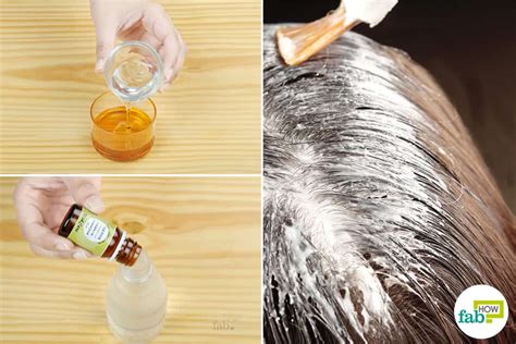 home remedies  dry flaky scalp  work fab