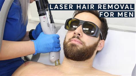 laser hair removal  men     clients  men youtube