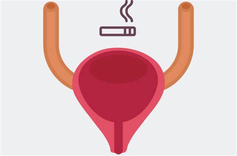 ‘surprising link smoking and bladder cancer health essentials from