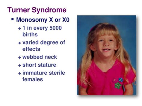 Ppt Chromosomal Abnormalities In Humans Powerpoint Presentation Free