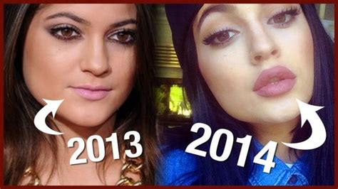 kylie jenner lips 10 kylie jenner plastic surgery