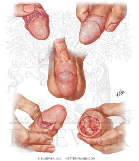 the netter collection of medical illustrations reproductive system