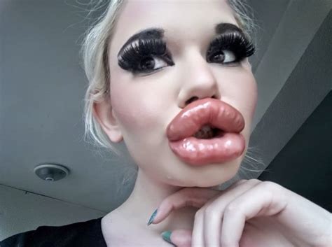 world s biggest lips woman goes viral after getting 20 lip injections