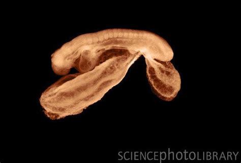 day  human embryo        pinterest microscopic