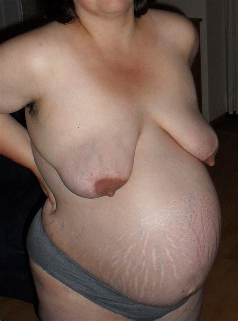 pregnant porn stretch marks